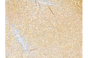 ABIN7094489 and ABIN7098538 at 1/100 staining Rat liver tissue by IHC-P.