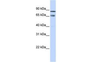 Image no. 1 for anti-IKAROS Family Zinc Finger 1 (Ikaros) (IKZF1) (AA 252-301) antibody (ABIN6742212) (IKZF1 抗体  (AA 252-301))