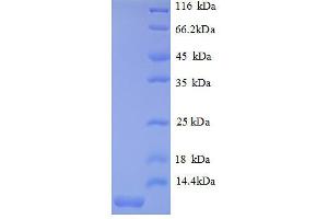 SDS-PAGE (SDS) image for Chemokine (C-X-C Motif) Ligand 2 (CXCL2) (AA 28-100), (full length) protein (His tag) (ABIN1046724)