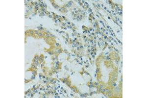 Immunohistochemistry (Paraffin-embedded Sections) (IHC (p)) image for anti-Tight Junction Protein 2 (Zona Occludens 2) (TJP2) (AA 951-1190) antibody (ABIN1683322)