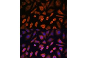 Immunofluorescence analysis of L-929 cells using N-WASP/WASL Polyclonal Antibody (ABIN3016273, ABIN3016274, ABIN3016275, ABIN1683282 and ABIN6219682) at dilution of 1:100 (40x lens). (Neural Wiskott-Aldrich syndrome protein (WASL) (AA 1-250) 抗体)