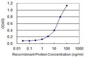 Detection limit for recombinant GST tagged CTBS is 0. (CTBS 抗体  (AA 37-105))
