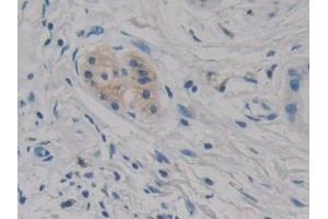 Immunohistochemistry (IHC) image for anti-Cell Death-Inducing DFFA-Like Effector C (CIDEC) (AA 1-251) antibody (ABIN7440137)