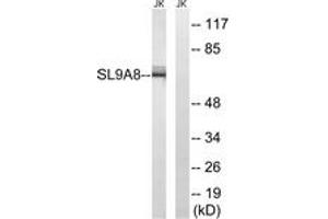 Western Blotting (WB) image for anti-Solute Carrier Family 9 (Sodium/hydrogen Exchanger), Member 8 (SLC9A8) (AA 451-500) antibody (ABIN1535382)