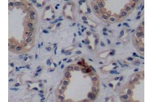 Immunohistochemistry (IHC) image for anti-Receptor tyrosine-protein kinase erbB-2 (ErbB2/Her2) (AA 376-578) antibody (ABIN7426373)