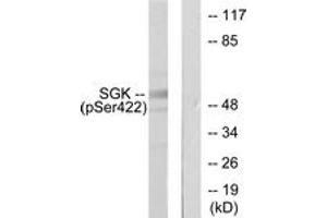 Western blot analysis of extracts from HeLa cells treated with Insulin 0. (SGK1 抗体  (pSer422))