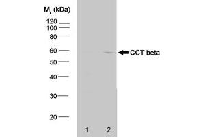 Western blot analysis of HeLa whole cell lysate (1) and HeLa heat stressed whole cell (CCT2 抗体)
