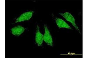 Immunofluorescence of purified MaxPab antibody to CRKL on HeLa cell. (CrkL 抗体  (AA 1-303))