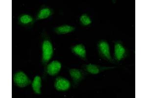IF analysis of PTPN22 using anti-PTPN22 antibody (ABIN7599374).