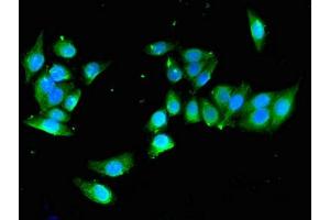 Immunofluorescent analysis of PC-3 cells using ABIN7166338 at dilution of 1:100 and Alexa Fluor 488-congugated AffiniPure Goat Anti-Rabbit IgG(H+L) (YIPF3 抗体  (AA 2-148))