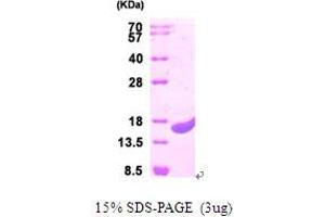 SDS-PAGE (SDS) image for Protein CutA (CUTA) (AA 33-179) protein (His tag) (ABIN666985) (CUTA Protein (AA 33-179) (His tag))