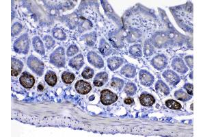 IHC analysis of IGF1 Receptor using anti-IGF1 Receptor antibody . (IGF1R 抗体  (AA 31-257))