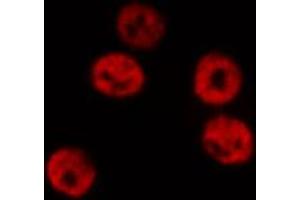 Immunofluorescence (fixed cells) (IF/ICC) image for anti-Signal Transducer and Activator of Transcription 6, Interleukin-4 Induced (STAT6) (pTyr641) antibody (ABIN6256781)