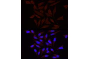 Immunofluorescence analysis of HeLa using FA/PIEZO1 antibody (ABIN6133207, ABIN6145612, ABIN6145613 and ABIN6220594) at dilution of 1:100 (40x lens).