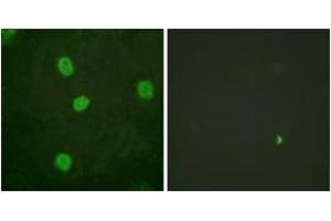 Immunofluorescence (IF) image for anti-V-Myb Myeloblastosis Viral Oncogene Homolog (Avian)-Like 2 (MYBL2) (AA 551-600), (pSer577) antibody (ABIN1531525)
