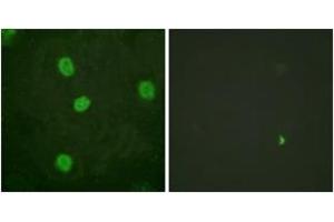 Immunofluorescence analysis of HeLa cells, using B-Myb (Phospho-Ser577/581) Antibody. (MYBL2 抗体  (pSer577))
