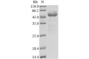 (Tris-Glycine gel) Discontinuous SDS-PAGE (reduced) with 5 % enrichment gel and 15 % separation gel.