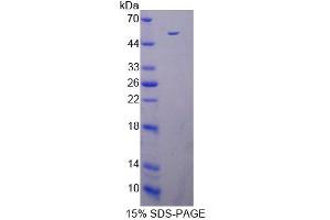 SDS-PAGE analysis of Mouse DAPK3 Protein. (DAPK3 蛋白)