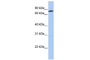 WB Suggested Anti-ZNF226 Antibody Titration:  0.