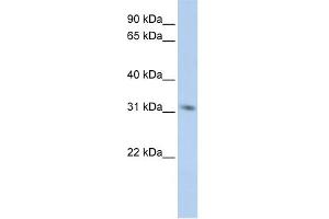 WB Suggested Anti-MPG Antibody Titration:  0. (MPG 抗体  (Middle Region))