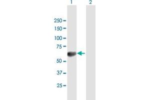 Western Blot analysis of TOM1 expression in transfected 293T cell line by TOM1 MaxPab polyclonal antibody. (TOM1 抗体  (AA 1-492))