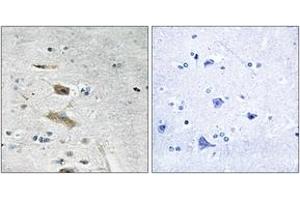 Immunohistochemistry analysis of paraffin-embedded human brain tissue, using ABHD4 Antibody. (ABHD4 抗体  (AA 251-300))