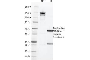 SDS-PAGE Analysis of Purified HCG-beta Rabbit Recombinant Monoclonal Antibody (HCGb/1996R). (Recombinant CGB 抗体)