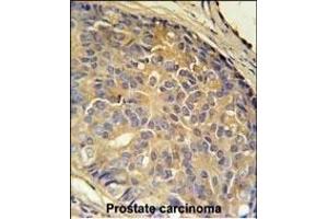 Immunohistochemistry (Paraffin-embedded Sections) (IHC (p)) image for anti-Loss of Heterozygosity, 12, Chromosomal Region 1 (LOH12CR1) (AA 167-196), (C-Term) antibody (ABIN651991)