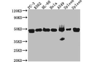 Western Blot Positive WB detected in: PC-3 whole cell lysate, K562 whole cell lysate, HL-60 whole cell lysate, A549 whole cell lysate, Mouse Spleen whole cell lysate, Rat Spleen whole cell lysate All lanes: Arp3 Antibody at 1:1000 Secondary Goat polyclonal to rabbit IgG at 1/50000 dilution Predicted band size: 48 kDa Observed band size: 48 kDa (Recombinant ACTR3 抗体)