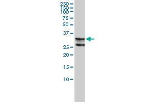 HNRPA2B1 monoclonal antibody (M01A), clone 1G12-6C5 Western Blot analysis of HNRPA2B1 expression in K-562 . (HNRNPA2B1 抗体  (AA 1-249))