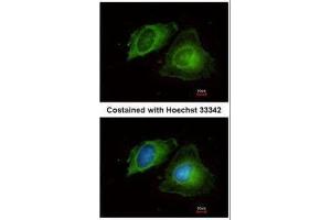 ICC/IF Image Immunofluorescence analysis of methanol-fixed HeLa, using MMP17, antibody at 1:200 dilution. (MMP17 抗体)