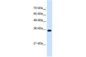Western Blotting (WB) image for anti-ATPase, Na+/K+ Transporting, beta 1 Polypeptide (ATP1B1) (Middle Region) antibody (ABIN2781852)