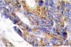 Immunohistochemistry (Paraffin-embedded Sections) (IHC (p)) image for anti-Collagen, Type I, alpha 2 (COL1A2) (Chain alpha 2) antibody (ABIN498442)
