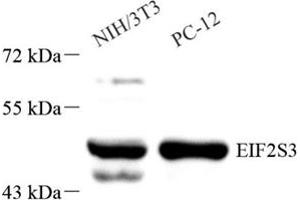 Western blot analysis of EIF2S3 (ABIN7073881),at dilution of 1: 1000