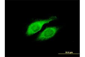 Immunofluorescence of purified MaxPab antibody to LYPLA2 on HeLa cell. (LYPLA2 抗体  (AA 1-231))