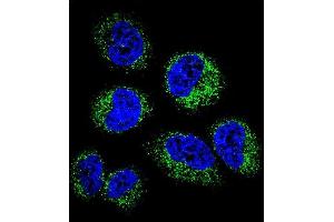 Confocal immunofluorescent analysis of GGH Antibody (C-term) (ABIN655984 and ABIN2845368) with NCI- cell followed by Alexa Fluor 488-conjugated goat anti-rabbit lgG (green). (GGH 抗体  (C-Term))