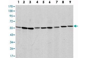 Western blot analysis using AIFM1 monoclonal antibody, clone 4E7  against NIH/3T3 (1), Jurkat (2), HeLa (3), HepG2 (4), MOLT 4 (5), C6 (6), Raji (7), COS-7 (8) and PC-12 (9) cell lysate.