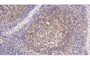 Detection of EP300 in Human Lymph node Tissue using Polyclonal Antibody to E1A Binding Protein P300 (EP300) (p300 抗体  (AA 1351-1601))