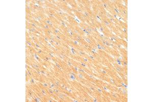 Immunohistochemistry of paraffin-embedded rat heart using MYBPC3 antibody (ABIN6129601, ABIN6144221, ABIN6144222 and ABIN6215951) at dilution of 1:100 (40x lens). (MYBPC3 抗体  (AA 200-400))