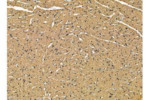 ABIN7095321 and ABIN7099378 at 1/100 staining rat heart tissue by IHC-P.