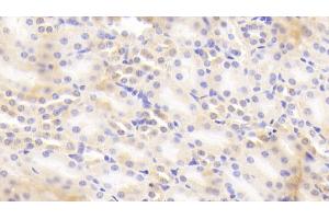 Detection of b2M in Mouse Kidney Tissue using Polyclonal Antibody to Beta-2-Microglobulin (b2M) (beta-2 Microglobulin 抗体  (AA 22-119))
