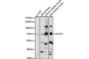 Western blot analysis of extracts of various cell lines, using KLHL41 antibody (ABIN7268084) at 1:1000 dilution. (Kelch-like protein 41 (KLHL41) (AA 1-300) 抗体)