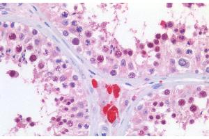 Immunohistochemistry (IHC) image for anti-Karyopherin alpha 2 (RAG Cohort 1, Importin alpha 1) (KPNA2) (C-Term) antibody (ABIN185157)