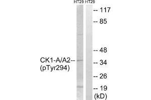 Western blot analysis of extracts from HT-29 cells treated with heat shock using CK-1α (Phospho-Tyr294) Antibody. (CSNK1A1 抗体  (pTyr294))