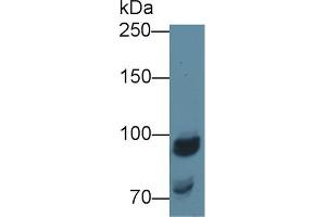 Detection of NAGLU in Porcine Kidney lysate using Polyclonal Antibody to N-Acetyl Alpha-D-Glucosaminidase (NAGLU) (N-Acetyl alpha-D-Glucosaminidase (AA 485-743) 抗体)