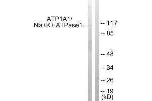 Western blot analysis of extracts from HeLa cells, using ATP1α1/Na+K+ ATPase1 (Ab-23) antibody. (ATP1A1 抗体  (Ser23))