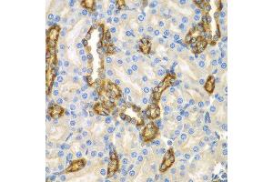 Immunohistochemistry of paraffin-embedded mouse kidney using CNPY3 antibody at dilution of 1:100 (x400 lens). (TNRC5 抗体)
