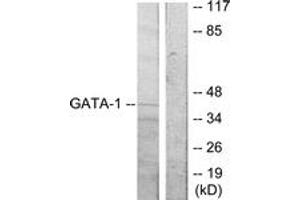 Western blot analysis of extracts from COS7 cells, using GATA1 (Ab-310) Antibody. (GATA1 抗体  (AA 277-326))