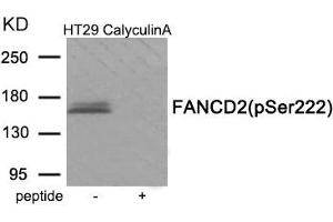 Western blot analysis of extracts from HT29 cells treated with CalyculinA using Phospho-FANCD2 (Ser222) antibody. (FANCD2 抗体  (pSer222))