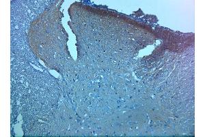 IHC on paraffin sections of rat spinal cord tissue using Rabbit antibody to pro BDNF (50-90): . (Pro BDNF 抗体)